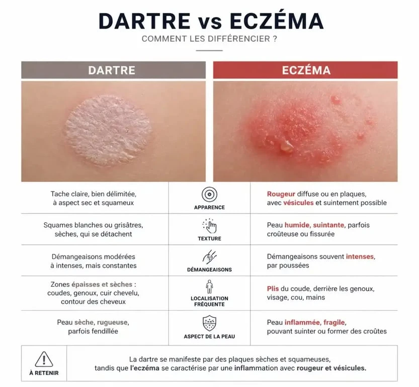 Comparaison visuelle entre dartre et eczéma pour mieux identifier les symptômes de la dartre peau