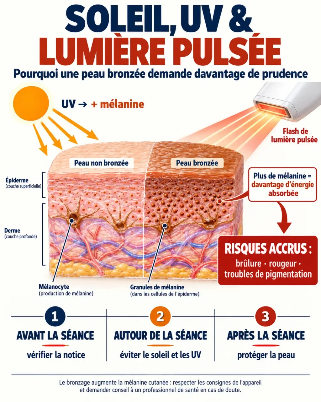 Infographie lumière pulsée soleil : rôle de la mélanine, risques du bronzage et précautions avant et après une séance